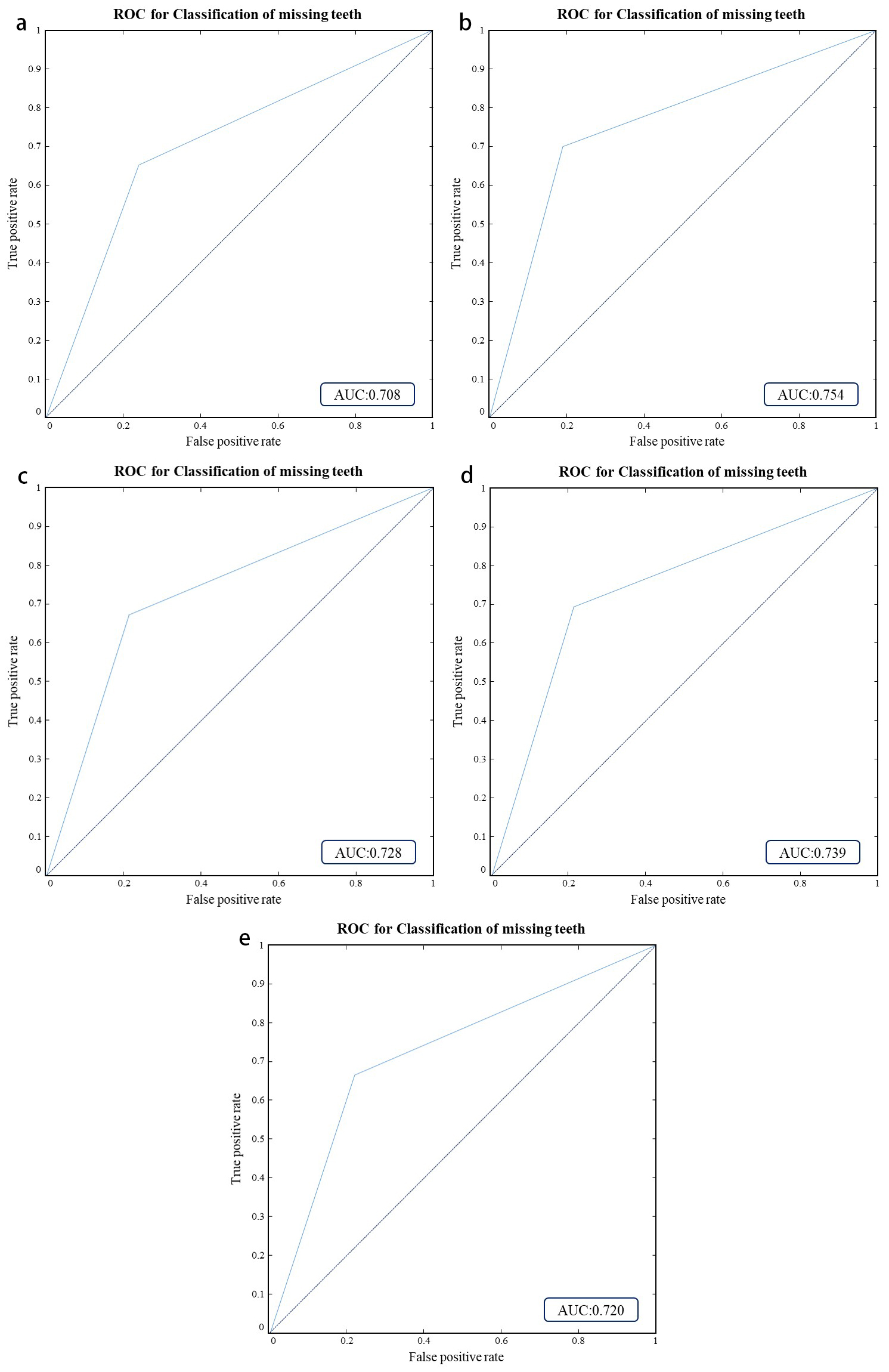 Receiver operating characteristic (ROC) curves of
5-fold cross-validation. (a) ROC of the first cross-validation. (b) ROC of the
second cross-validation. (c) ROC of the third cross-validation. (d) ROC of the
fourth cross-validation. (e) ROC of the fifth cross-validation. The area under
the ROC curve represents the AUC value. AUC: Area under the curve.