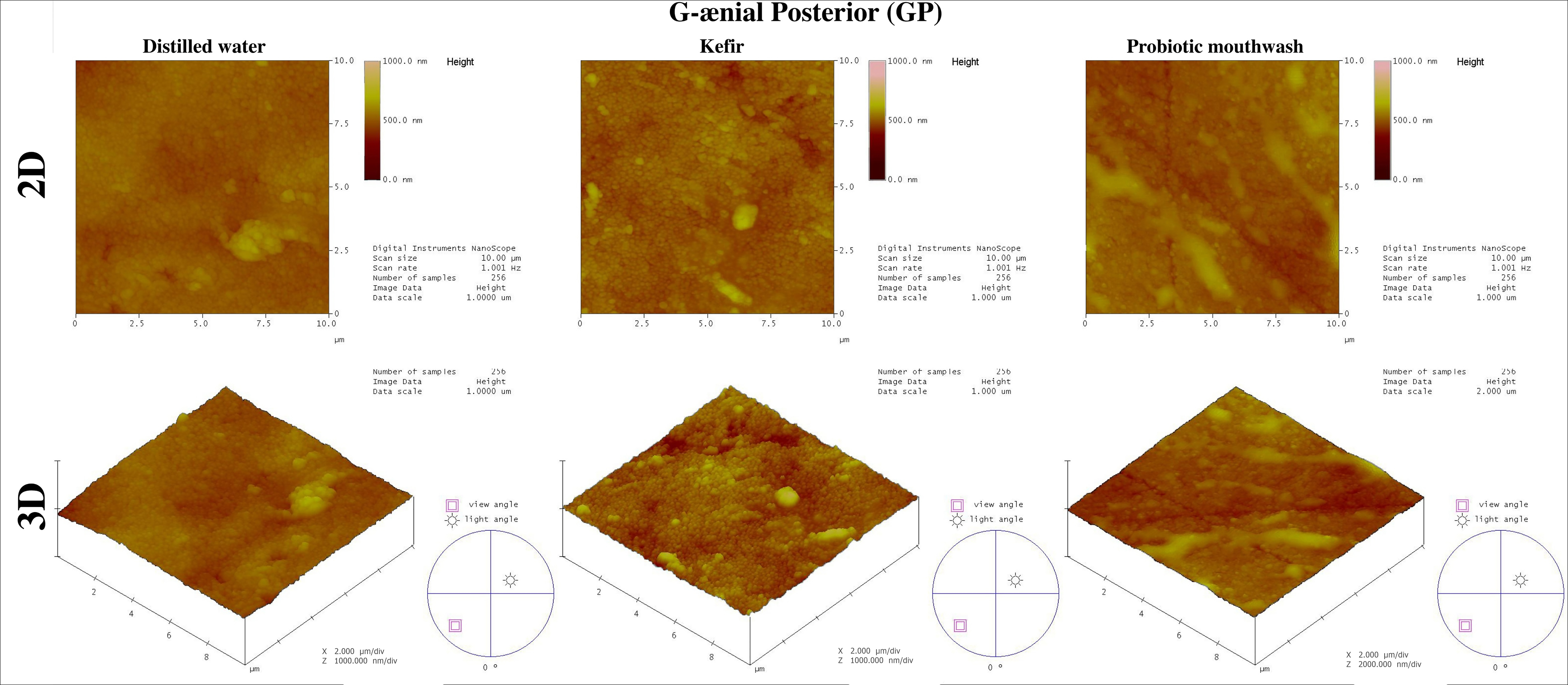Representative AFM images of the G-ænial Posterior (GP).