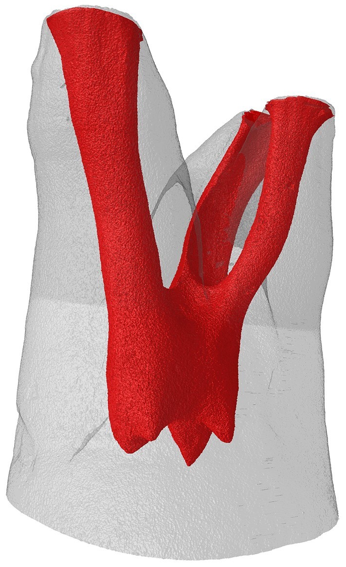 Reconstructed 3D micro-CT image or
third permanent immature maxillary molar.