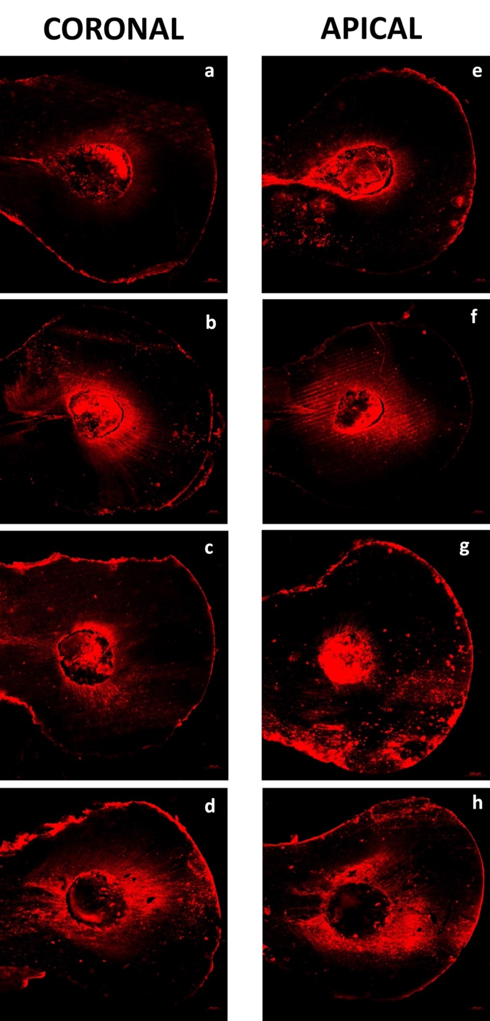 Confocal laser scanning microscopy images. (a) The coronal
region for the CNI group. (b) The coronal region for XPF group 2. (c) The coronal
region for the EA group. (d) The coronal region for the PUI group. (e) The apical
region for the CNI group. (f) The apical region for XPF group. (g) The apical
region for EA group. (h) The apical region for PUI group. CNI: Conventional Needle
Irrigation, XPF: The XP-Endo Finisher, EA: EndoActivator, PUI: Passive Ultrasonic
Irrigation.