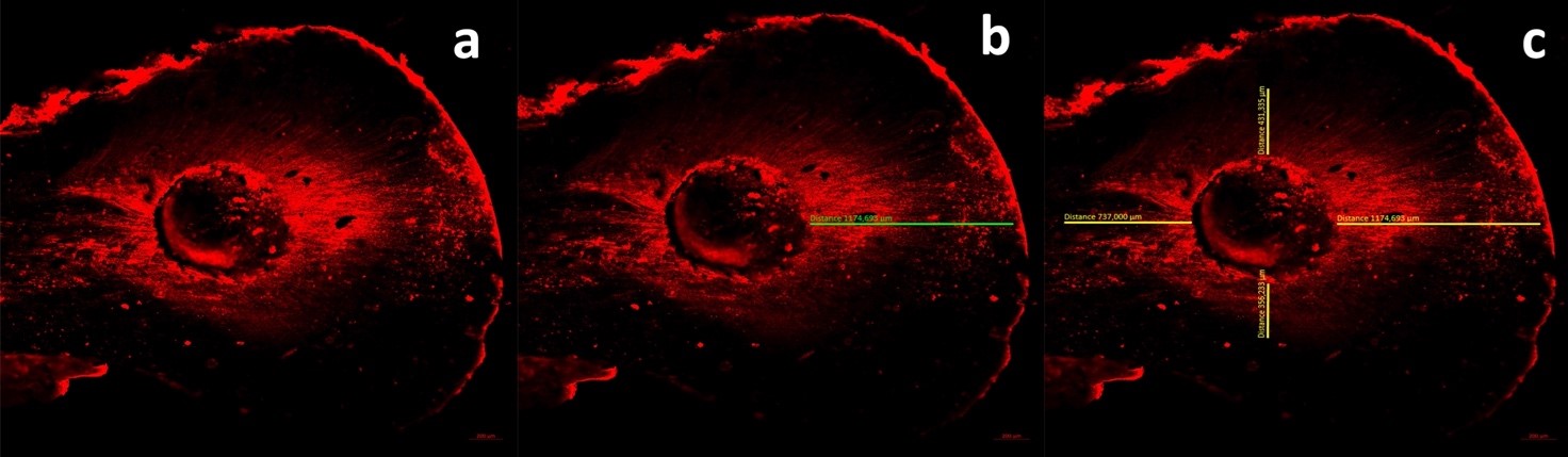 Confocal laser scanning microscopy images of the
sample. (a) The sample image without measurement. (b) Measuring the maximum dentin
tubule penetration depth. (c) Measuring the mean dentin tubule penetration depth.