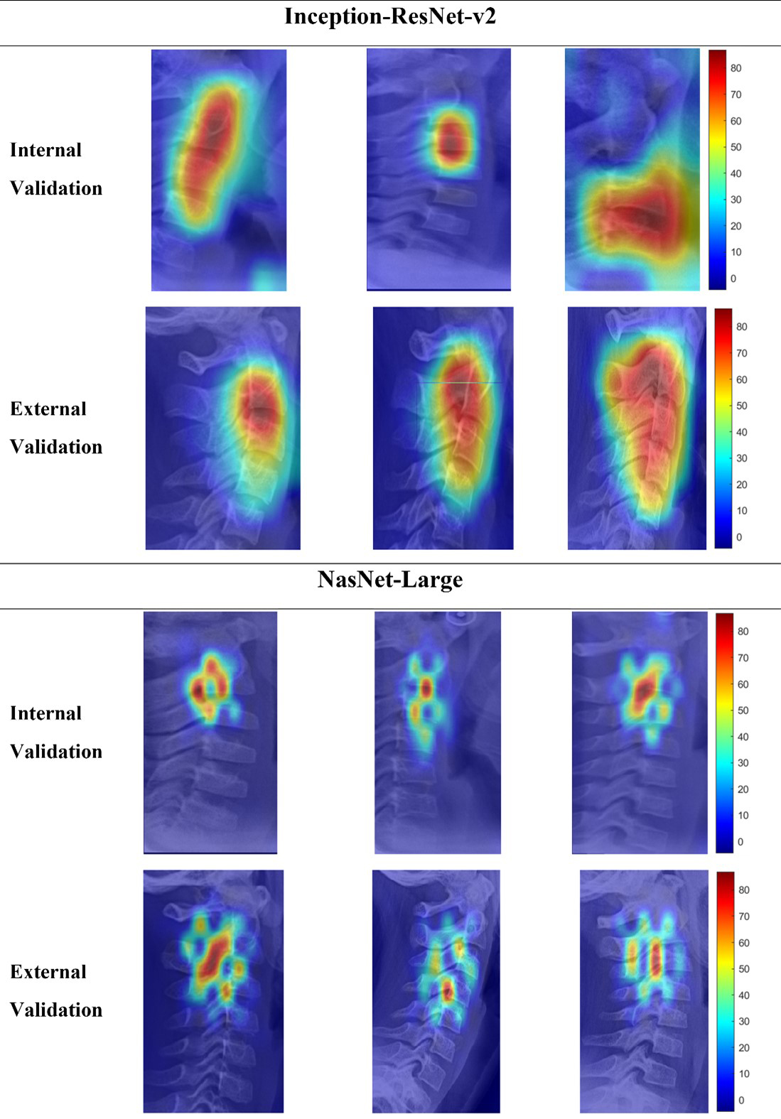 Grad-RAM images of the regions of interest (ROIs) including the
cervical vertebrae during internal and external validation. In this case, the
InceptionResNet-v2 model activation map exhibited a different pattern compared to
that of the NasNet-Large model, which was somewhat sporadic.