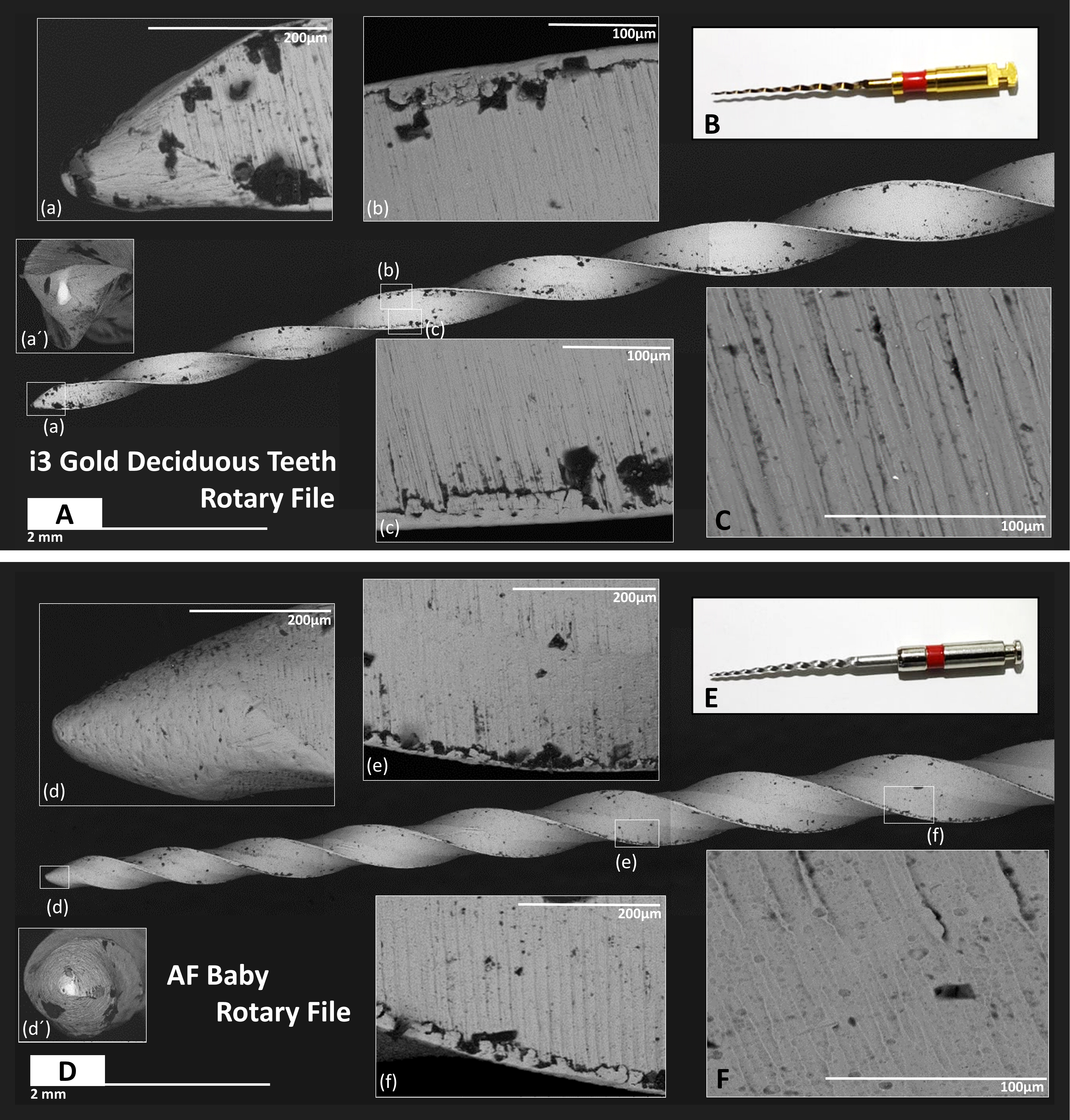 Scanning electron micrographs. (A) Approximately the first 8 mm
of a new ISO 25/04 i3 Gold deciduous teeth rotary file; (a,a’) Tip of the file
(observe several surface irregularities, they retain many particles from the
oil); (b,c) Surface flutes and cutting edges (observe “rolling over” of the
cutting edges); (B) Photograph of the same instrument; (C) High magnification on
a random central zone of the i3G-f (observe the presence of numerous superficial
fissures). (D) Scanning electron micrographs of approximately the first 8 mm of a
new ISO 25/04 AF baby rotary file; (d,d’) Tip of the file (observe a smother
surface with no irregularities, the surface prevented retention of particles from
the oil); (e,f) Surface flutes and cutting edges (observe a lower “rolling
over” of the cutting edges in comparison with i3 Gold deciduous teeth rotary
file); (E) Photograph of the same instrument; (F) High magnification on a random
central zone of the AF-f (observe the presence of rounded porosities on the
surface).