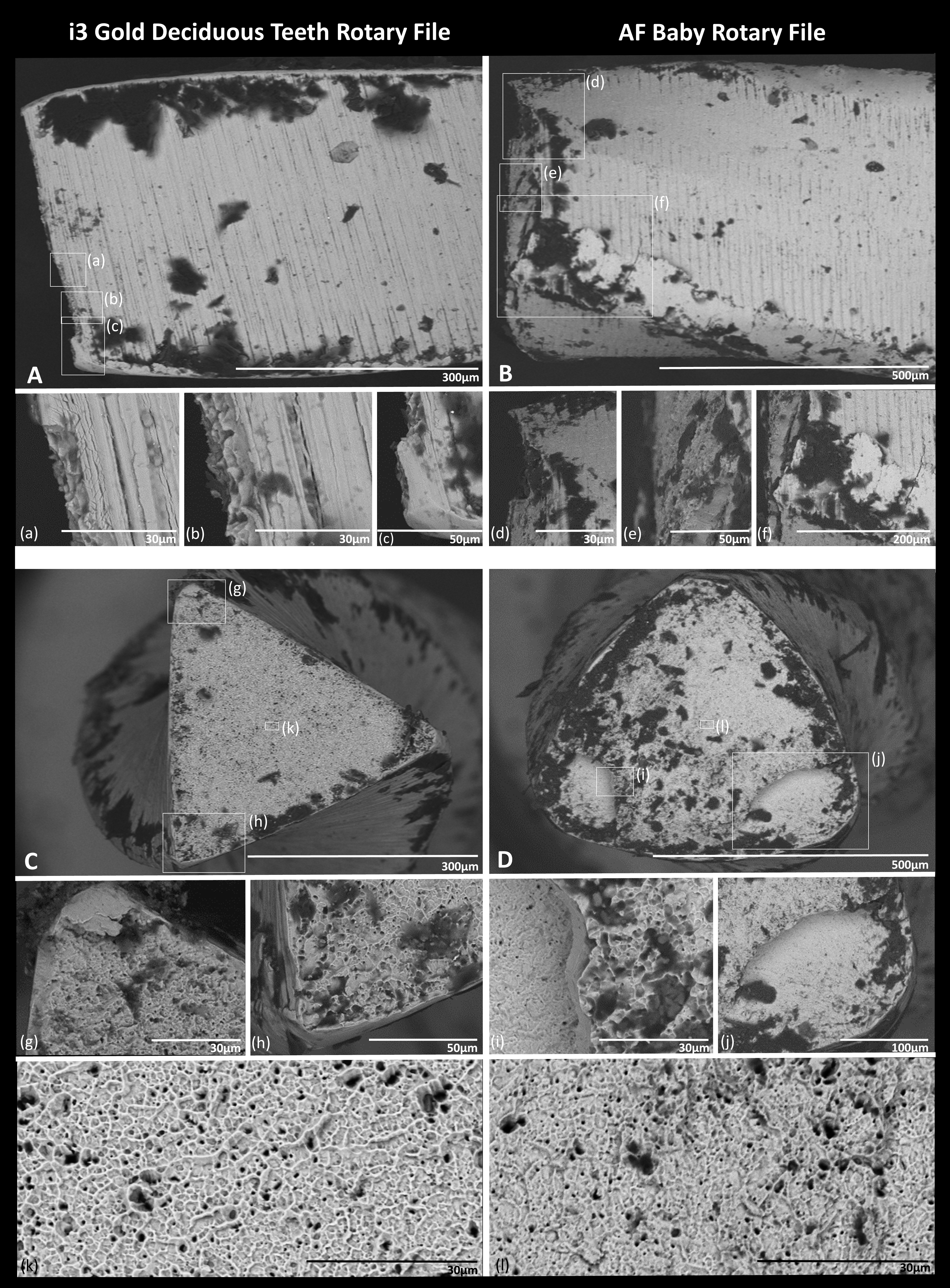 Scanning electron micrographs of the fractured files. (A,B)
Horizontal view of the files showing the fracture in relation to the shaft.
(a–f) Enlargement of the fractured zones (observe the numerous cracks close to
the fracture site in a,b but not in e,f). (C,D) Cross-section view of the
fractured files. (g–j) Enlargement of the fractured zones. (k,l) A high
magnification of the center of the files.