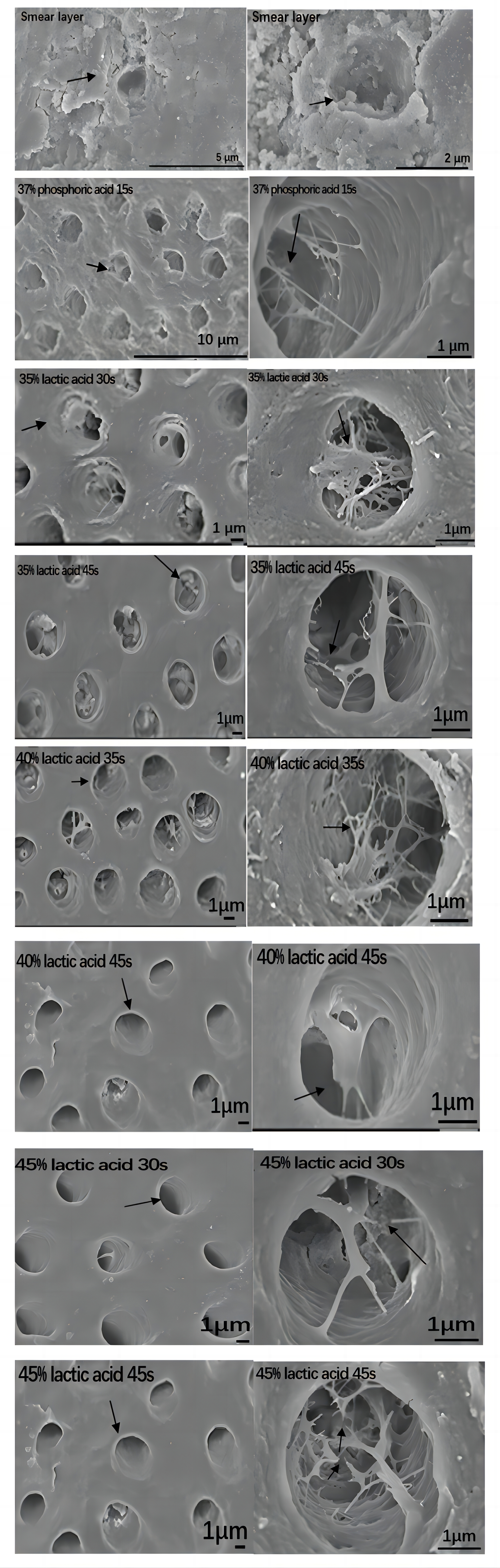 Scanning electron microscopic images of dentin interface in each
group.
