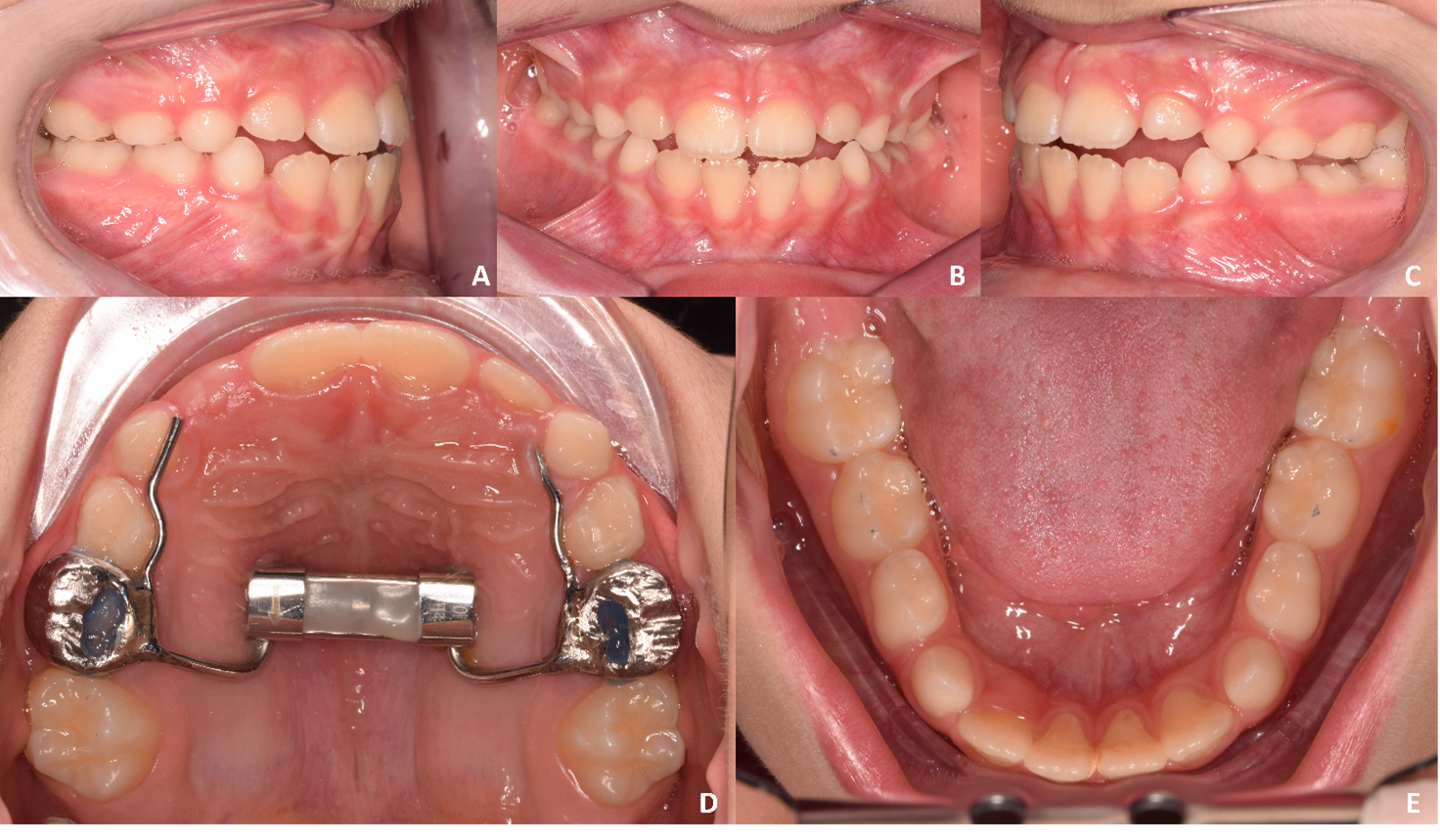 Journal of Clinical Pediatric Dentistry (JOCPD)