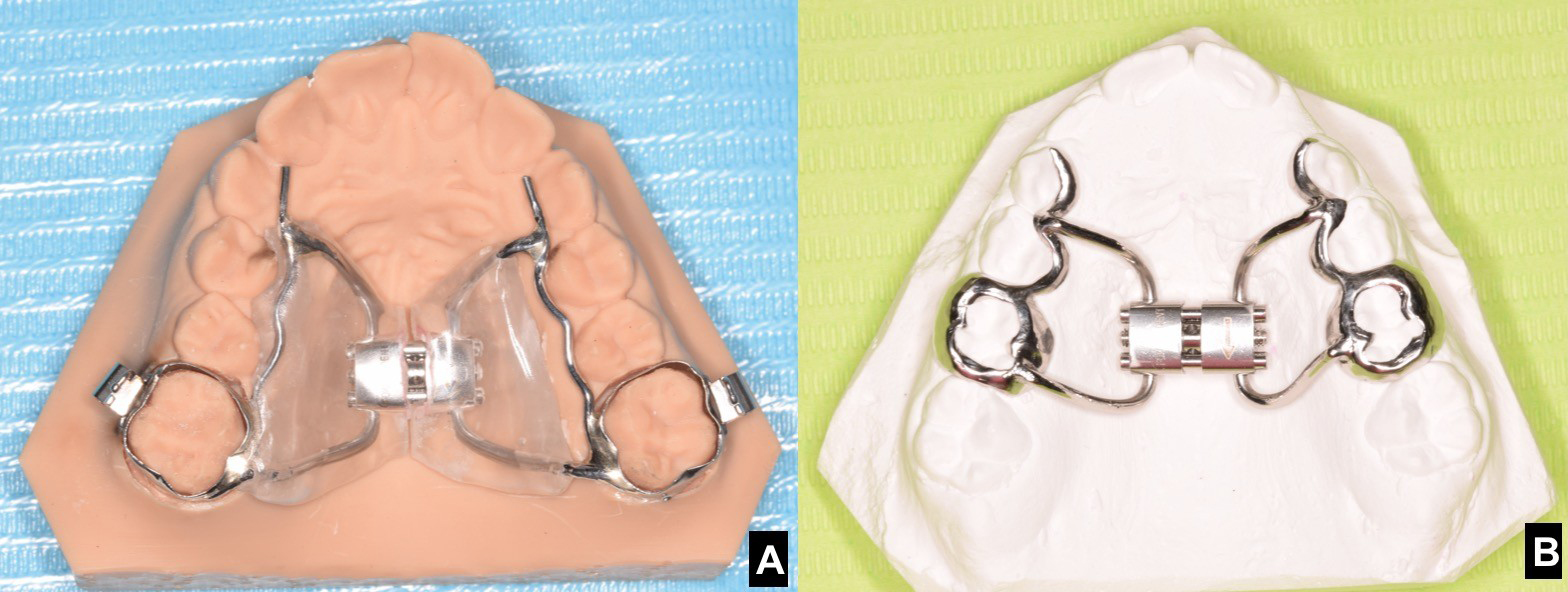 Journal of Clinical Pediatric Dentistry (JOCPD)