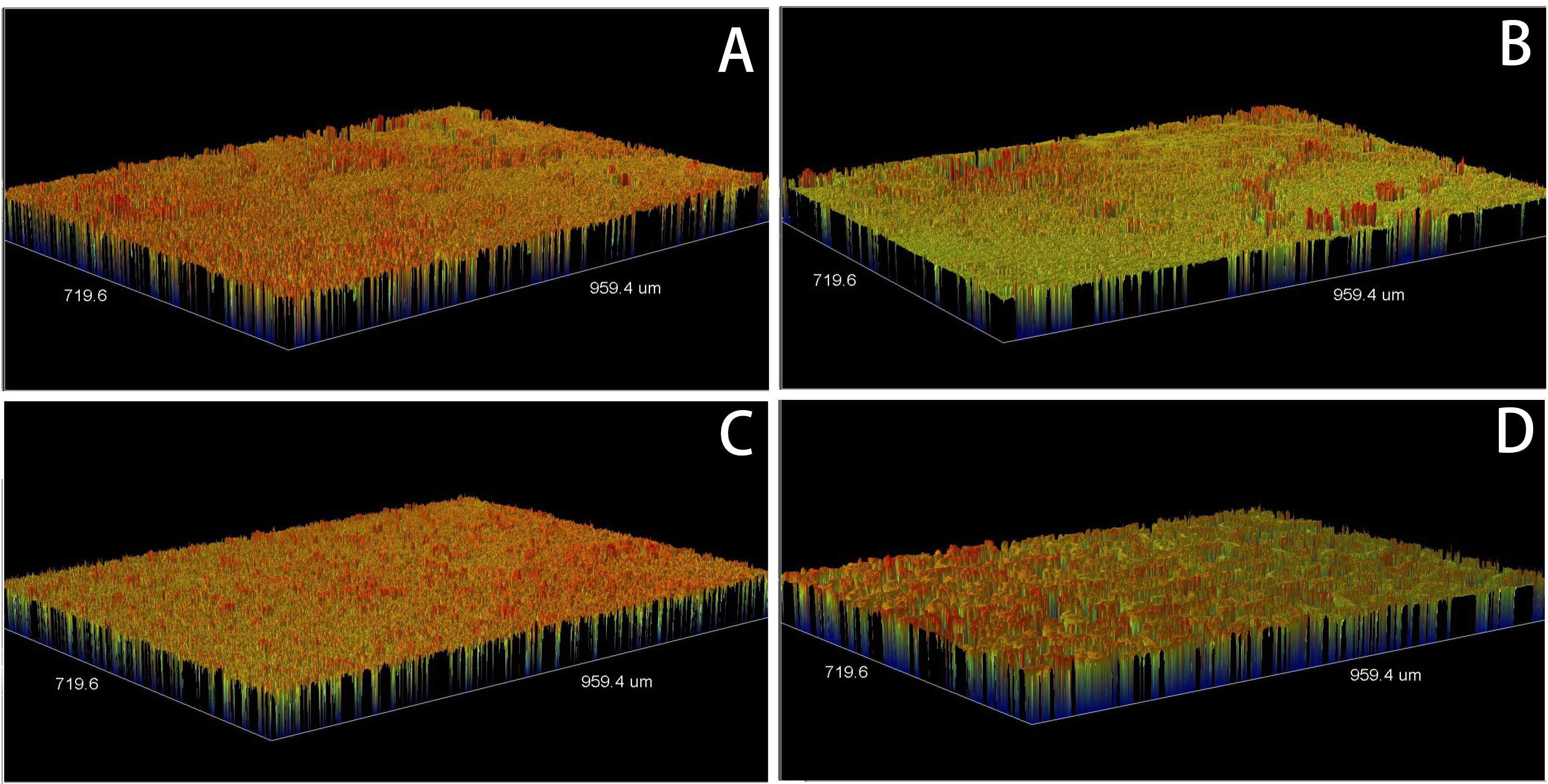 Surface profiles of the study specimens labelled A–D
representing GC, G1, G2 and G3, respectively.