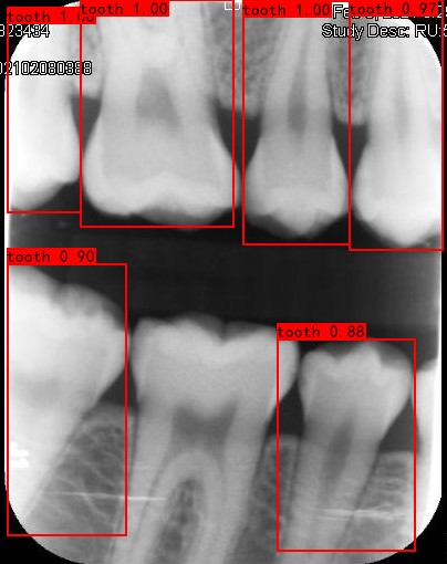 Co-Mask R-CNN: collaborative learning-based method for tooth instance segmentation figure 8