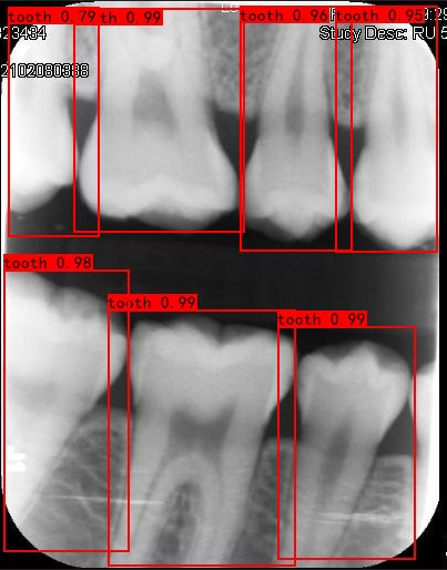 Co-Mask R-CNN: collaborative learning-based method for tooth instance segmentation figure 9