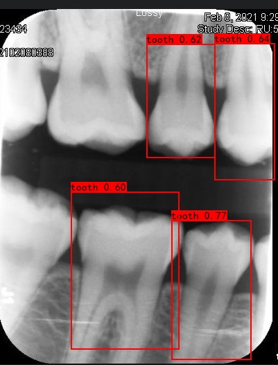 Co-Mask R-CNN: collaborative learning-based method for tooth instance segmentation figure 10