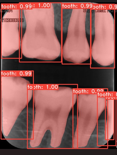 Co-Mask R-CNN: collaborative learning-based method for tooth instance segmentation figure 11