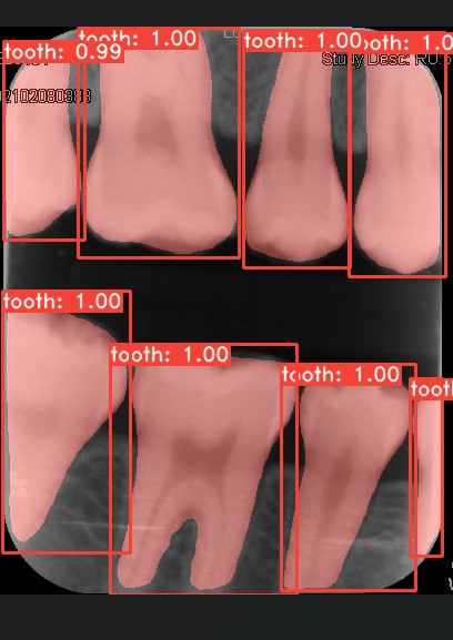 Co-Mask R-CNN: collaborative learning-based method for tooth instance segmentation figure 12