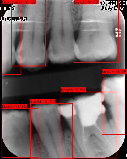 Co-Mask R-CNN: collaborative learning-based method for tooth instance segmentation figure 13