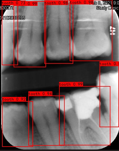 Co-Mask R-CNN: collaborative learning-based method for tooth instance segmentation figure 14