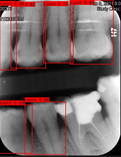 Co-Mask R-CNN: collaborative learning-based method for tooth instance segmentation figure 15