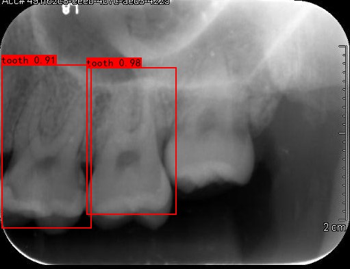 Co-Mask R-CNN: collaborative learning-based method for tooth instance segmentation figure 18
