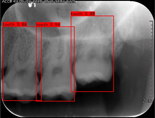 Co-Mask R-CNN: collaborative learning-based method for tooth instance segmentation figure 19