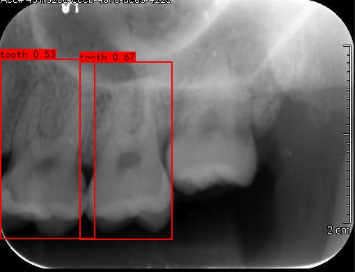Co-Mask R-CNN: collaborative learning-based method for tooth instance segmentation figure 20