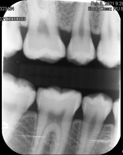 Co-Mask R-CNN: collaborative learning-based method for tooth instance segmentation figure 23