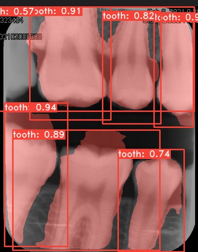 Co-Mask R-CNN: collaborative learning-based method for tooth instance segmentation figure 25