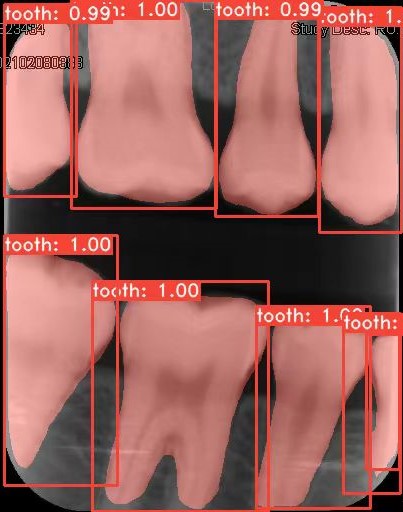 Co-Mask R-CNN: collaborative learning-based method for tooth instance segmentation figure 26