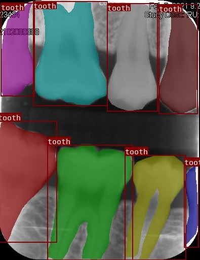 Co-Mask R-CNN: collaborative learning-based method for tooth instance segmentation figure 28
