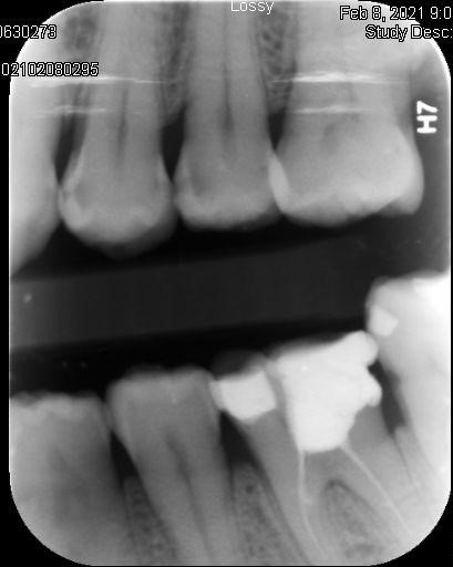Co-Mask R-CNN: collaborative learning-based method for tooth instance segmentation figure 29