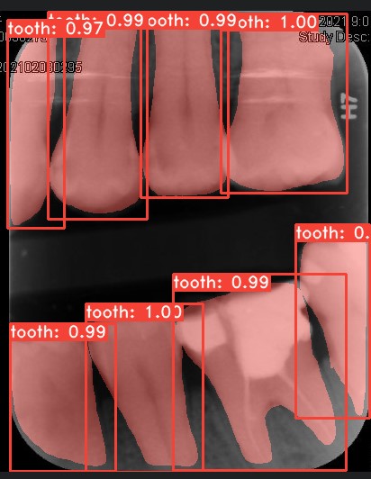 Co-Mask R-CNN: collaborative learning-based method for tooth instance segmentation figure 30