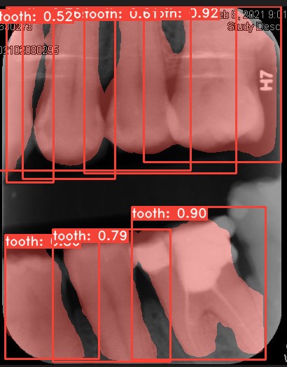 Co-Mask R-CNN: collaborative learning-based method for tooth instance segmentation figure 31