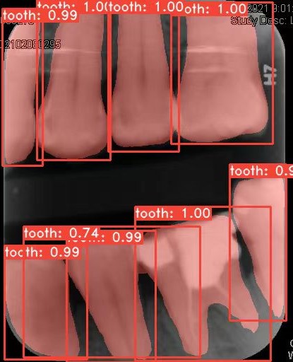 Co-Mask R-CNN: collaborative learning-based method for tooth instance segmentation figure 32
