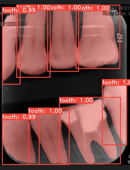 Co-Mask R-CNN: collaborative learning-based method for tooth instance segmentation figure 33