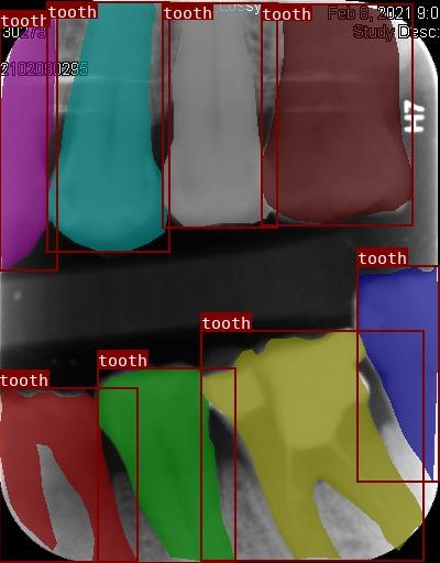 Co-Mask R-CNN: collaborative learning-based method for tooth instance segmentation figure 34