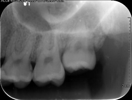 Co-Mask R-CNN: collaborative learning-based method for tooth instance segmentation figure 35