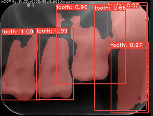 Co-Mask R-CNN: collaborative learning-based method for tooth instance segmentation figure 36