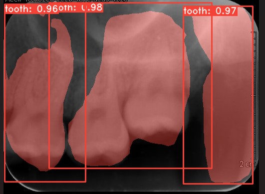 Co-Mask R-CNN: collaborative learning-based method for tooth instance segmentation figure 37