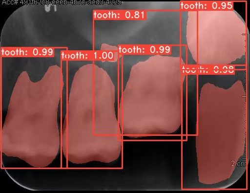 Co-Mask R-CNN: collaborative learning-based method for tooth instance segmentation figure 38