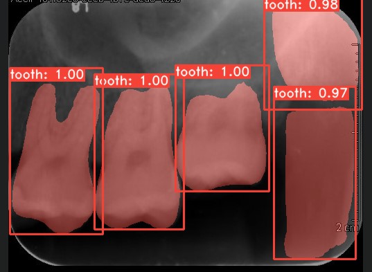 Co-Mask R-CNN: collaborative learning-based method for tooth instance segmentation figure 39