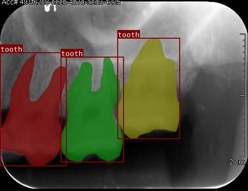 Co-Mask R-CNN: collaborative learning-based method for tooth instance segmentation figure 40