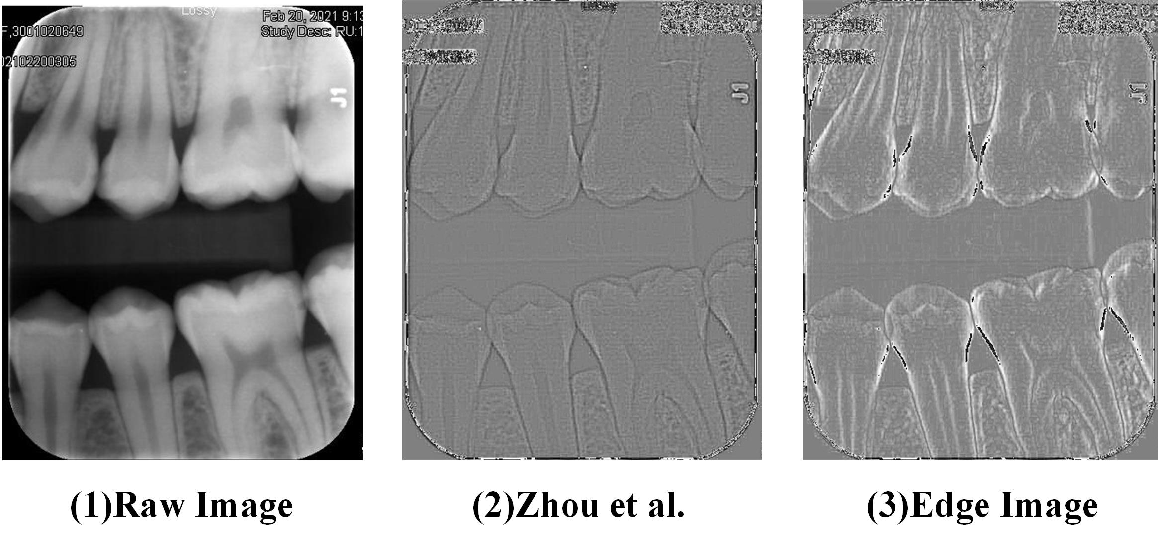 Image enhancement
results.