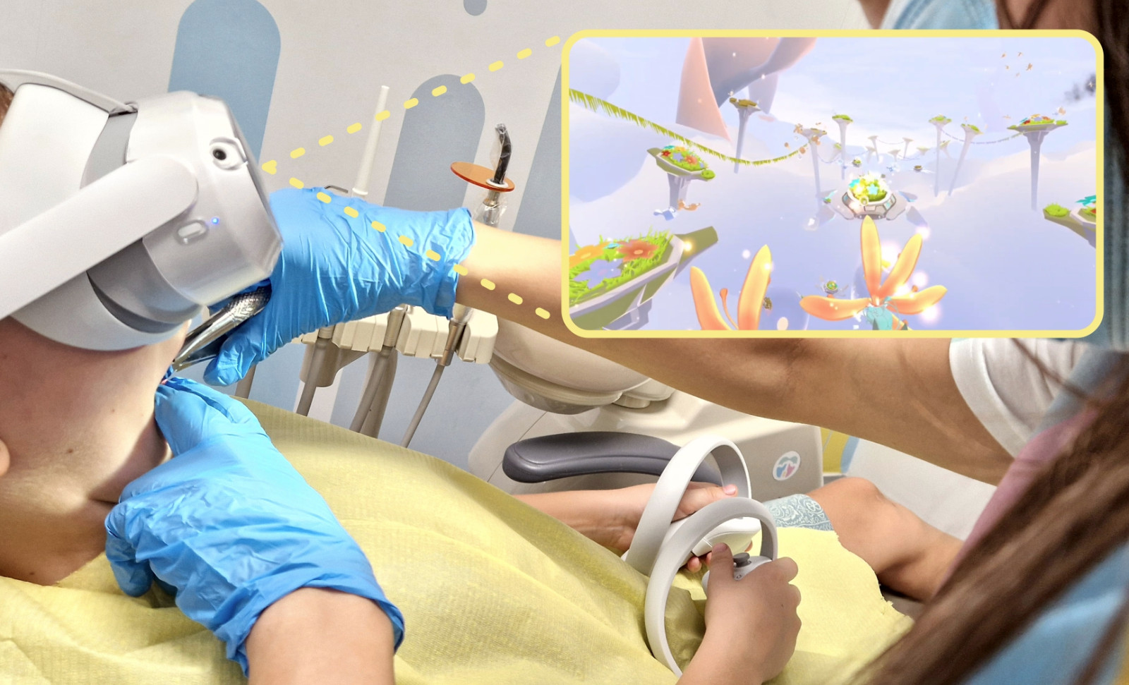 The tooth extraction phase with VR goggles featuring framed VR
content that the patient sees during the procedure.