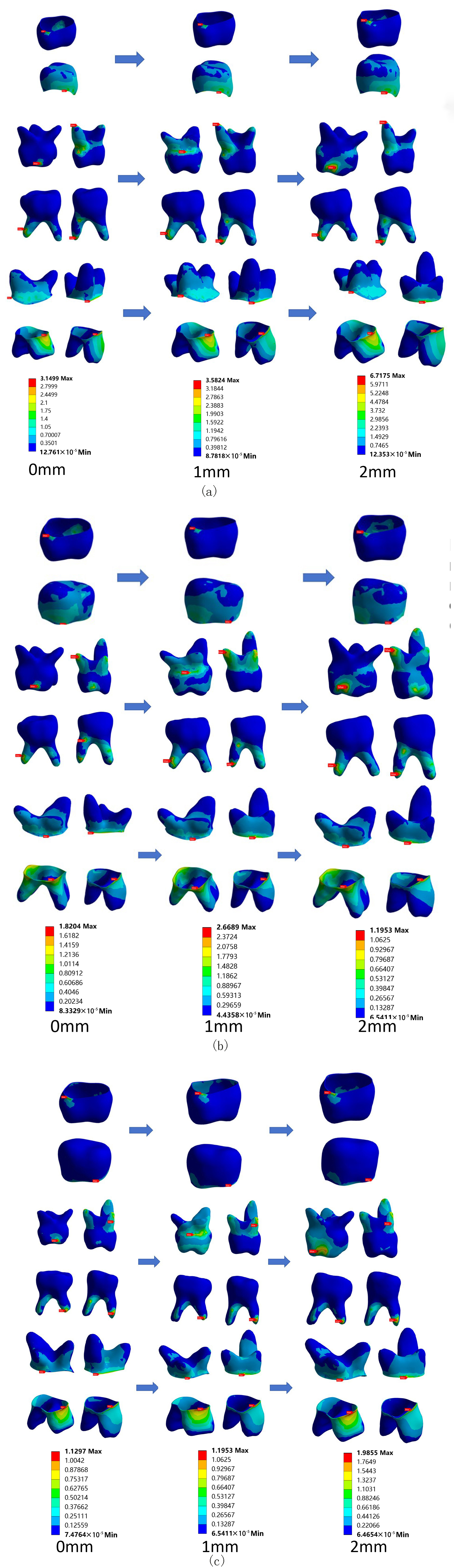 Stress Cloud Charts of SSCs 
repairing the first and second deciduous molars individually, 
as well as simultaneously. (a) Group B2, (b) Group B3, (c) Group B1.