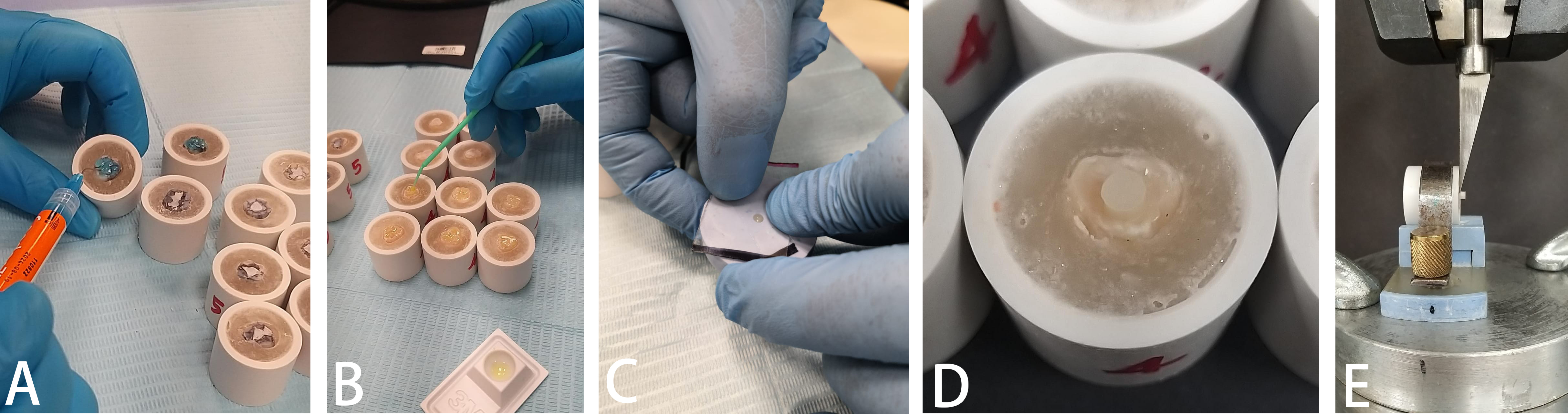 Preparation for adhesion test. (A) Acid Etching application,
(B) Bonding agent application, (C) Putty Index placed at the center of the
occlusal surface, (D) Sealant Application, (E) Universal testing machine with
customized stainless steel knife edge.