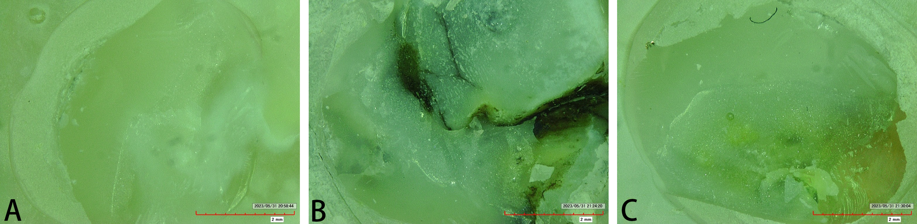 Specimens’ evaluation of the Adhesive Remnants Index (ARI) under
digital microscope 50× showing remaining sealant in enamel. (A) FS
group, (B) SDF + FS group, (C) SDF + KI + FS group.