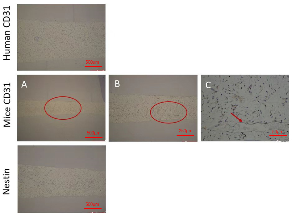 Immunohistochemical staining of the negative control group
(Group C). Human Nestin and CD31 immunohistochemical were negative
(×20). The second row of images localization of Mice CD31 localization.
(A) Canal tissue is rich in blood vessels (×20); (B) enlargement of the
circled area in panel A (×40); (C) red arrow indicates blood vessel.