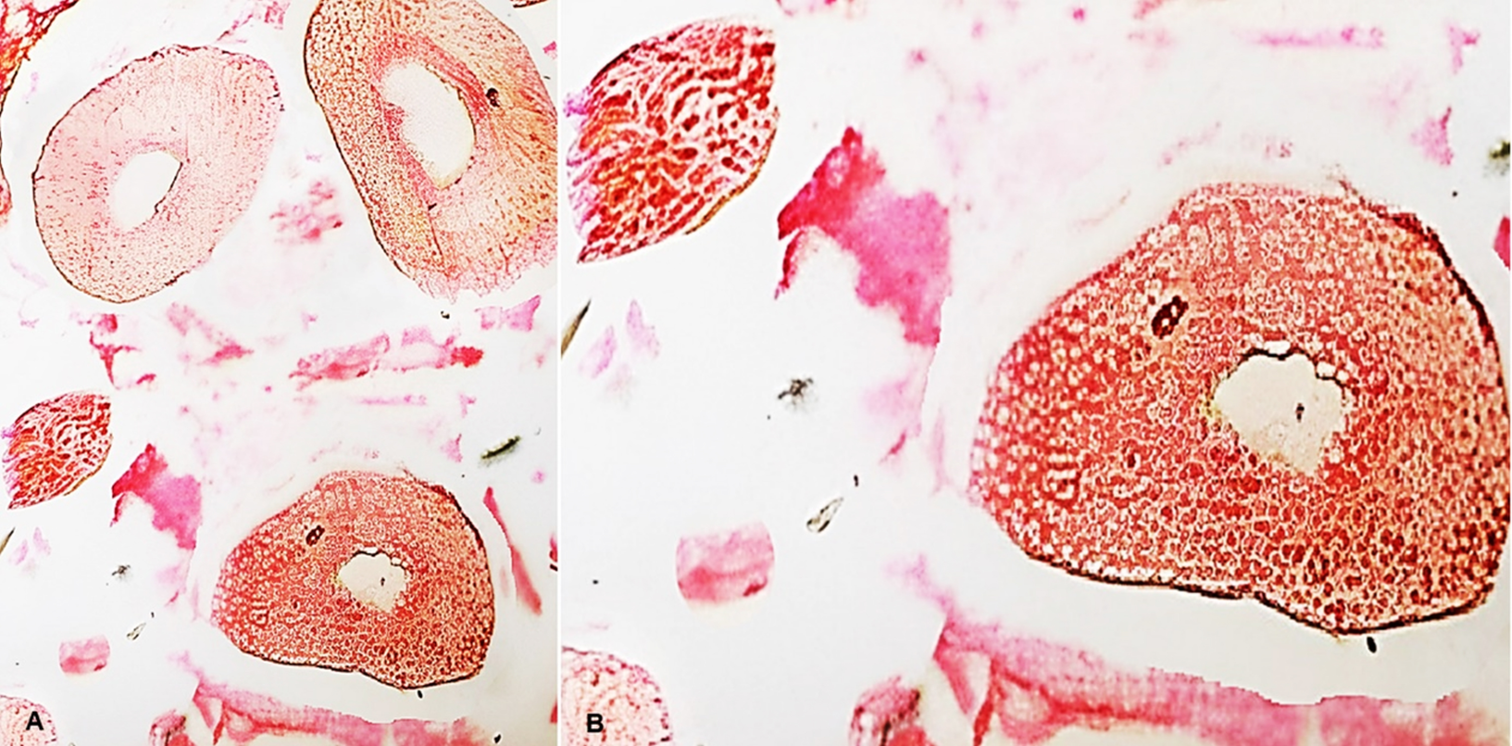 The histological
examination of compound odontoma showed enamel, dentin and pulp tissue in
organized form Hematoxylin Eosin Staining with magnification. (A) 10×
and (B) 40×.