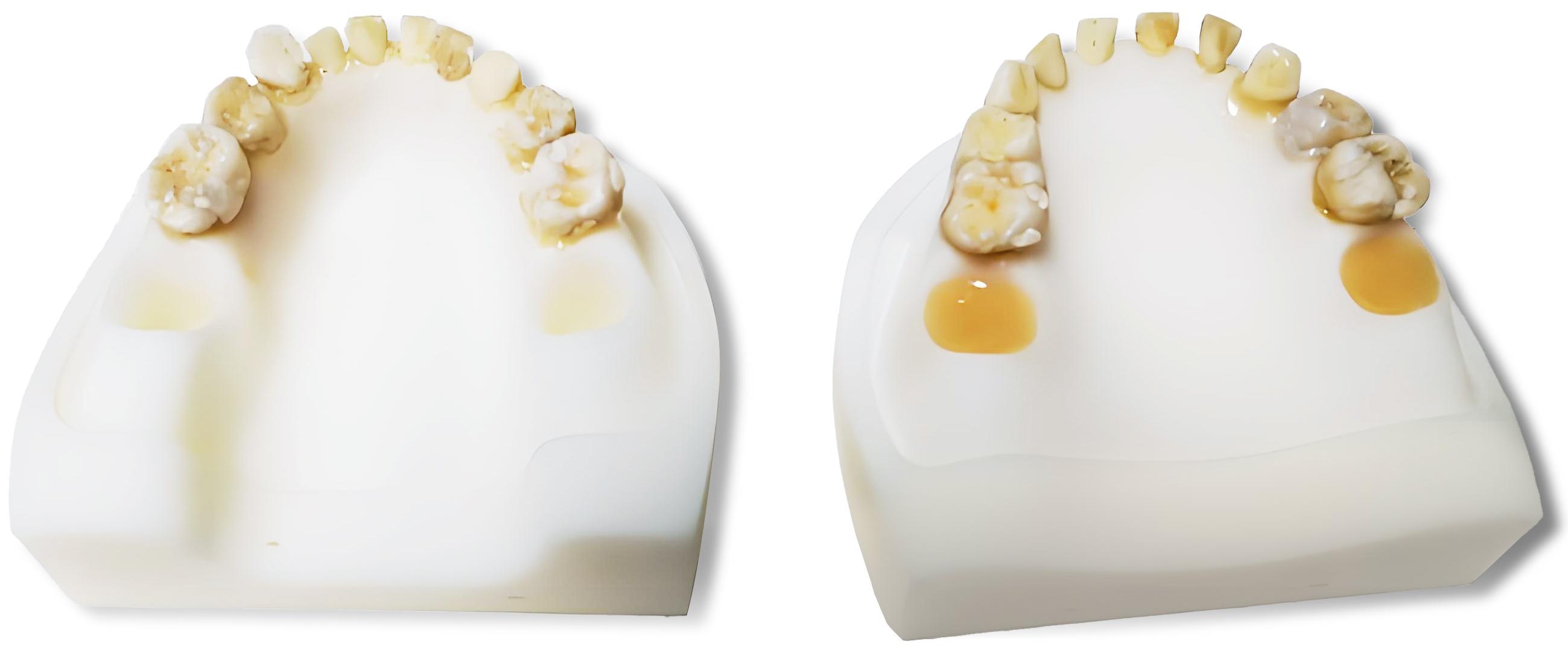 Representative image of simulated dental arches.