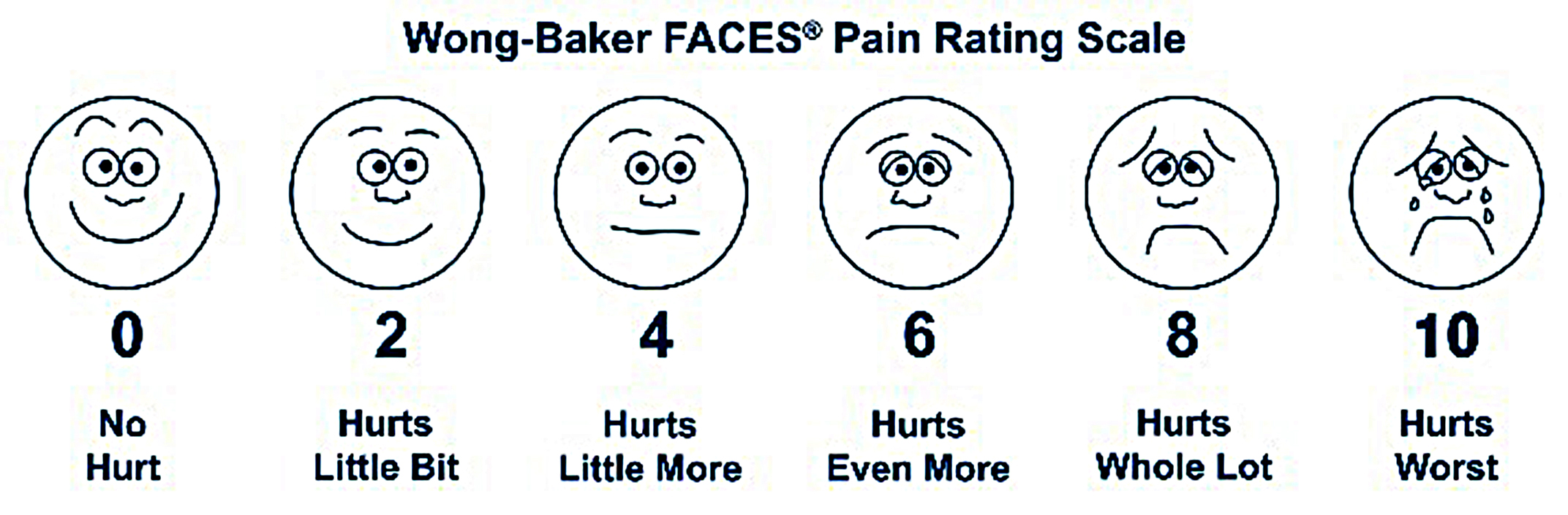 Wong-Baker FACE® pain rating scale.