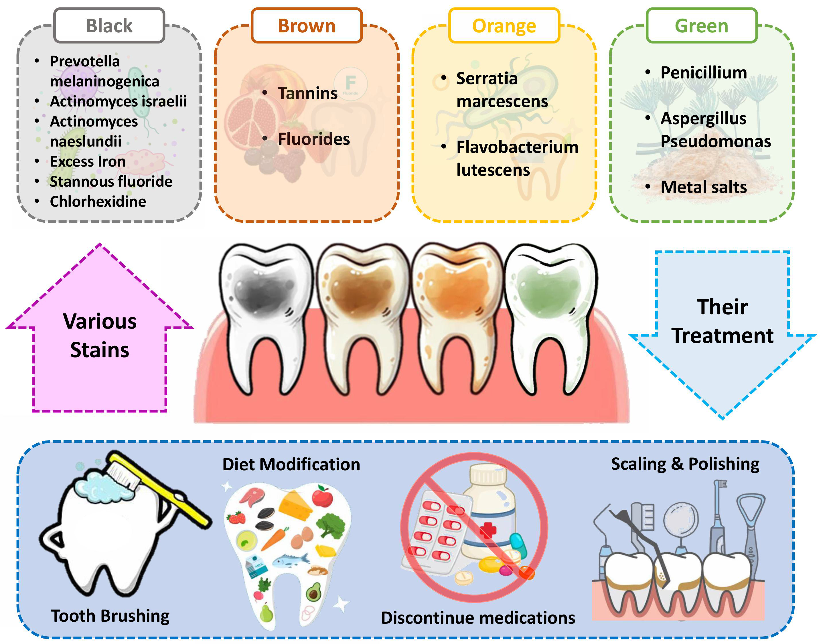 Causes of various stains and their treatment.