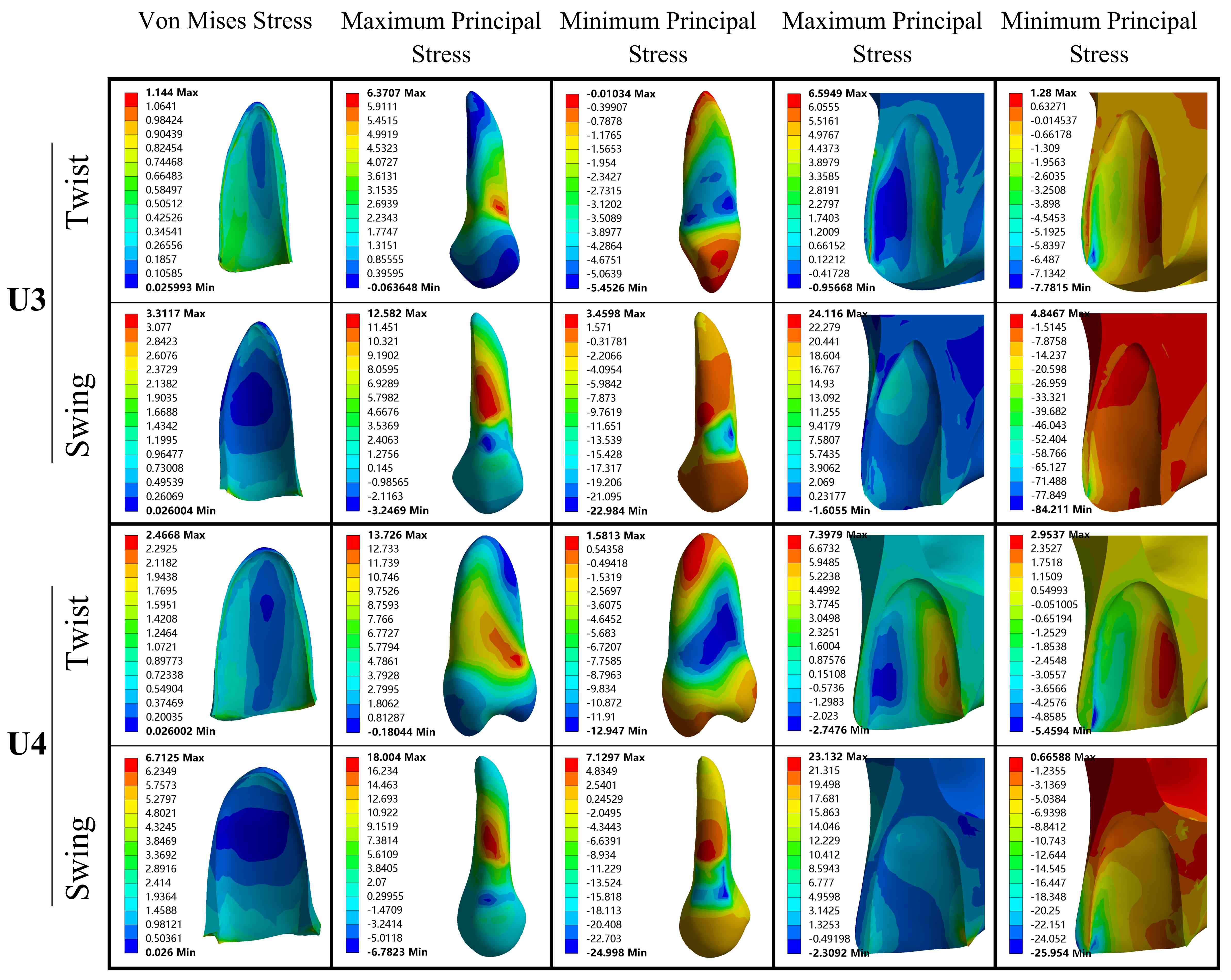 Stress distribution in U3 and U4. The figure illustrates the 
difference in stress distribution between the torsion and swing methods on the U3 
and U4 tooth-PDL-alveolar bone complex. U3: upper jaw canine; U4: upper jaw 
premolar; Max: maximum; Min: minimum.